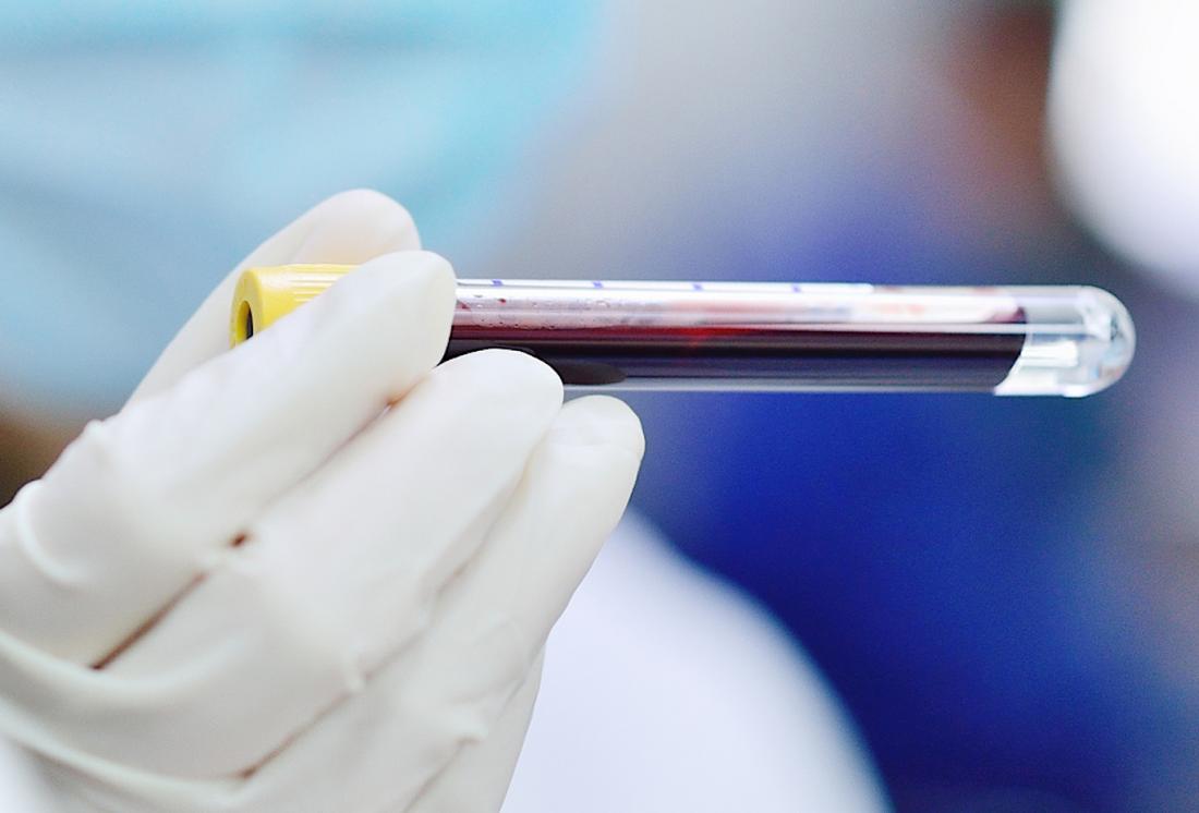 Gloved hand holding LH blood test sample