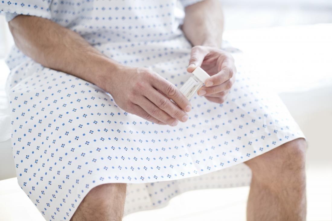 Man in hospital gown holding sample pot for sperm analysis